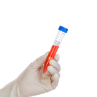 Dynarex Centrifuge Tubes